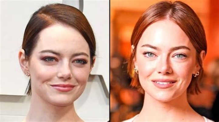 Emma Stone Face Lift: Unveiling the Truth Behind Her Stunning Transformation