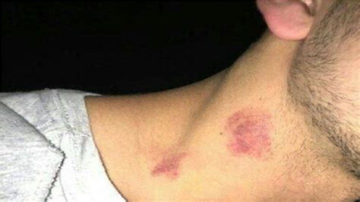 How to Give Yourself a Hickey: A Guide for Dummies