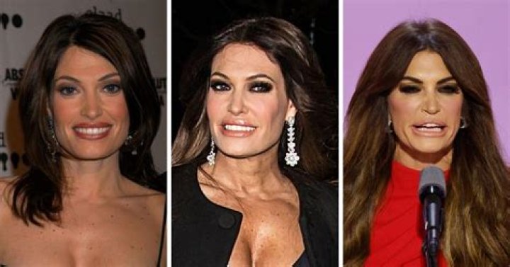 Kimberly Guilfoyle Surgery: Understanding the Procedure and Its Impact
