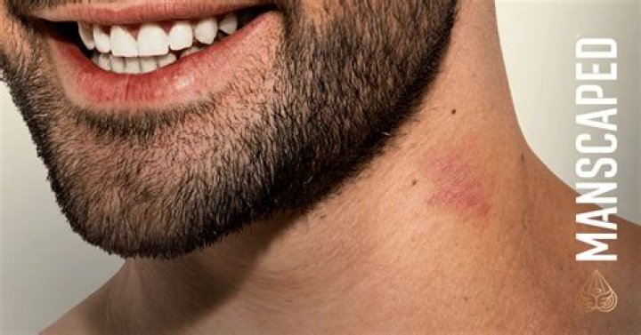 The Ultimate Guide to Giving Yourself a Hickey: Techniques and Safety Tips